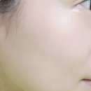 공단 피부관리실