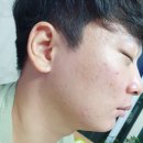 임성은에스테틱 | 소소한 결혼준비 :: 인천 여드름 관리 2회차 솔직후기, 임성은 에스테틱💘