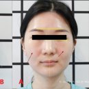 메디본 이미지
