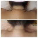 쓰리업샵 | 일산다이어트 림프관리로 독소배출시켜주는 관리로 목선라인찾은 쓰리업샵 추천