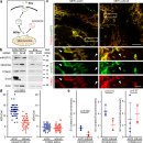 Re: 미토콘드리아의 전달 extracellular vesicle.. mito-vesicle.. 이미지