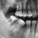 맥스덴치과의원 이미지