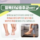 누리덴 네이버블로그