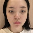 해운대 웨이브 | 부산 해운대 센텀 리프팅 후기 | 엑셀웨이브 브이올렛주사 이중턱 지방분해주사 리프팅레이저