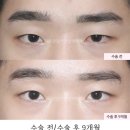 서연성형외과의원 이미지