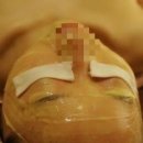 에스더피부 네이버블로그
