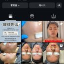 수디끌스킨