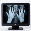 오만용치과의원 | 이빨 때문에 세상이 안 보이던 시절이 있었나.. 전주 365 치과 방문기