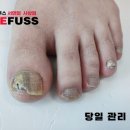 레푸스 사상점 이미지