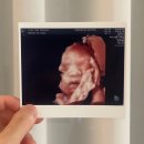 [👼🏻] 임신로그 27w-32w : 임신후기/여름임산부/만삭스냅//정기검진