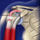 운동사전 이미지