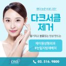 제이원성형외과 네이버블로그