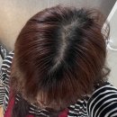 루틴스테이 | 하루 10분, 두피가 편안해지는 신개념 루틴 - 지루성·트러블성 두피 -STAYPACK 스테이팩 후기