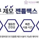 휴먼레이저