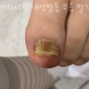 베티네일 이미지
