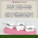 글로리아치과교정과치과의원 네이버블로그