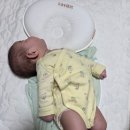 아주재활의학과의원 | 울산 아기 두상 교정 병원 [아주재활의학과의원]