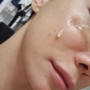 피부재생크림EGF 성분 기능과 관리 후기 실전은 다름