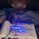 다니엘이비인후과의원 | 수면무호흡증 수면다원검사 후기,보험,시간,효과,준비물