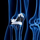 조앤조병원 이미지