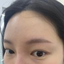 키닛브로우바
