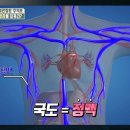 혈관의 고속도로, 동맥을 지켜라-겨울철 혈관 건강의 모든 것 이미지