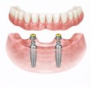 e웰니스치과의원 이미지