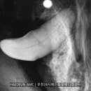 해든덴탈 이미지