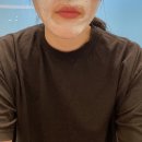 칠곡 “청담류 피부과” 점제거 후기:)