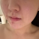 심지약국 | 수성구다이어트, 수성구순환관리, &#39;눕다이어트(NUB diet)&#39; V라인 관리 2주차 후기