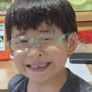 온유치과의원 | 속초에도 야간진료 가능한 소아 치과가 있다! 복덩이 유치 발치 기록