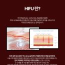 리프핏