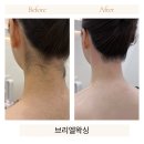 [공지] 용인 브라질리언 왁싱 유목민이 결국 브리엘에 정착하는 3가지 이유