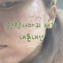 152약국 | 아가파의원 계양점 편평사마귀/점 제거 후기 152개 내돈내산