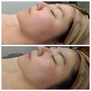 타이어킹박사(주) | 똑똑 여기 홍조 박사님이 계신다고 들었습니다만? 제주피부관리샵[AR 민낯 연구소]