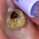 연세내일치과의원 이미지