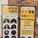 리오시스칼프