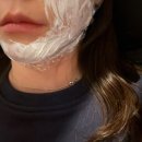 서울드림의원 | 내돈내산 울쎄라프라임 300샷 천호 미모드림의원 (기존 울쎄라와 비교 장점)