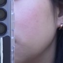 에스트라 에이시카365 흔적진정세럼 pH4.5 샘플링 키트 후기