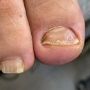 다시온 리케어 이미지