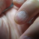 ‘손톱’의 중요성? 새로 알게된 놀라운 사실들 이미지