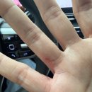 한국한센복지협회울산경남지부마산부설의원 이미지