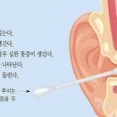 외이도염 및 주의사항은 이미지