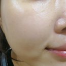 임마누엘피부관리 네이버블로그