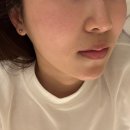 리포즈에스테틱 파주운정점 | 운정에스테틱 추천 드누에스테틱 파주운정점 LDM 얼굴케어 관리 후기