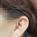 광명보청기난청센터 이미지