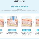 유니온의료기