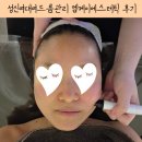 엠케이 | 성신여대 여드름관리 만족도 최고였던 엠케이에스테틱 아크네 인텐시브 후기