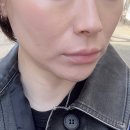 페이스 | 이수역 피부과 튠라이너 튠페이스 후기