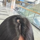 차종식피부과의원 | 대전 탈모피부과 원형탈모 탈모병원 추천